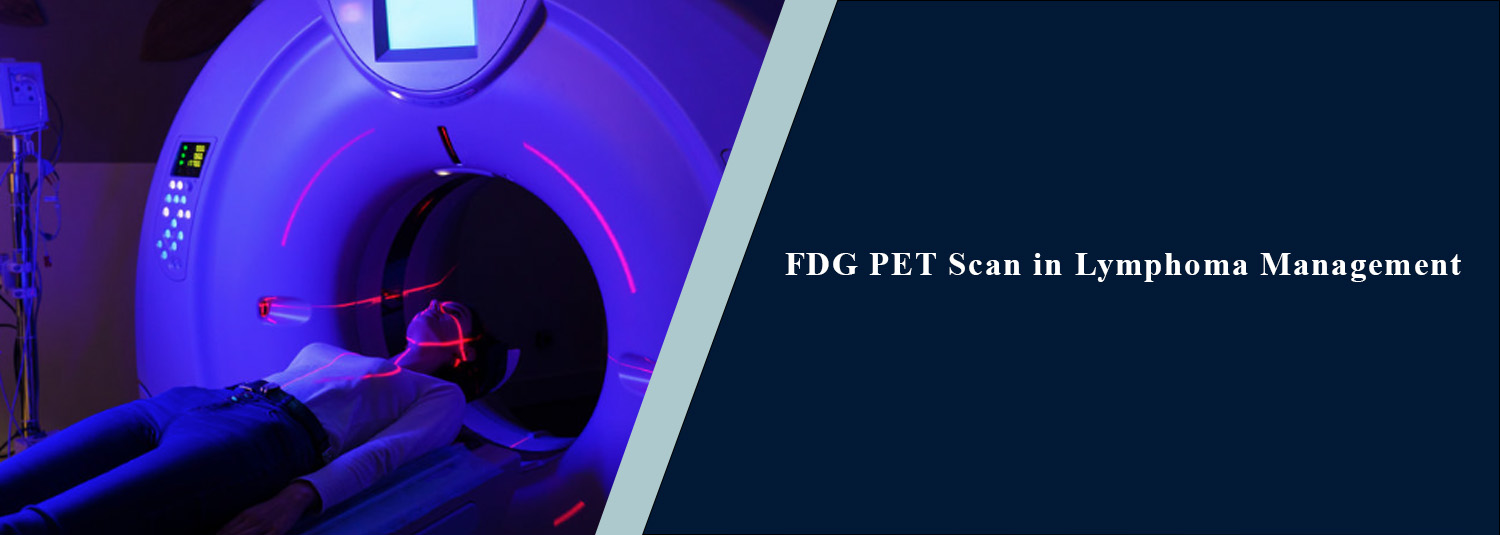 FDG PET Scan in Lymphoma Management