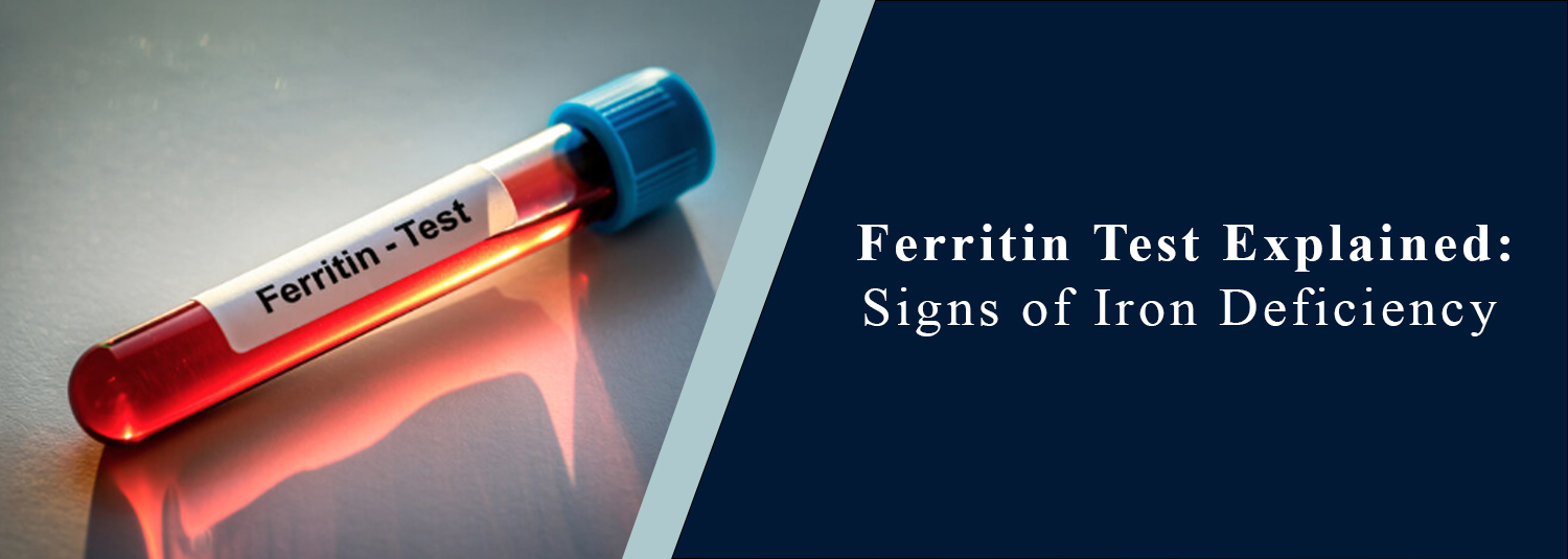Ferritin Test Explained: Signs of Iron Deficiency