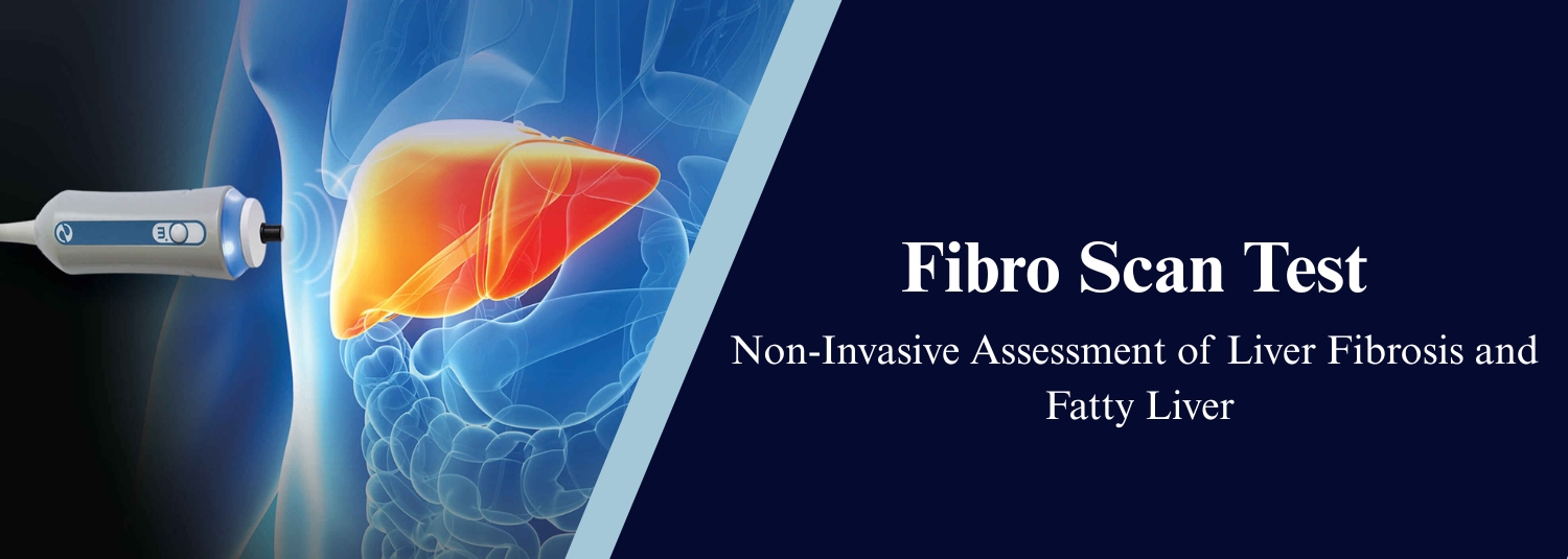 Fibro Scan Test Non-Invasive Assessment of Liver Fibrosis and Fatty Liver