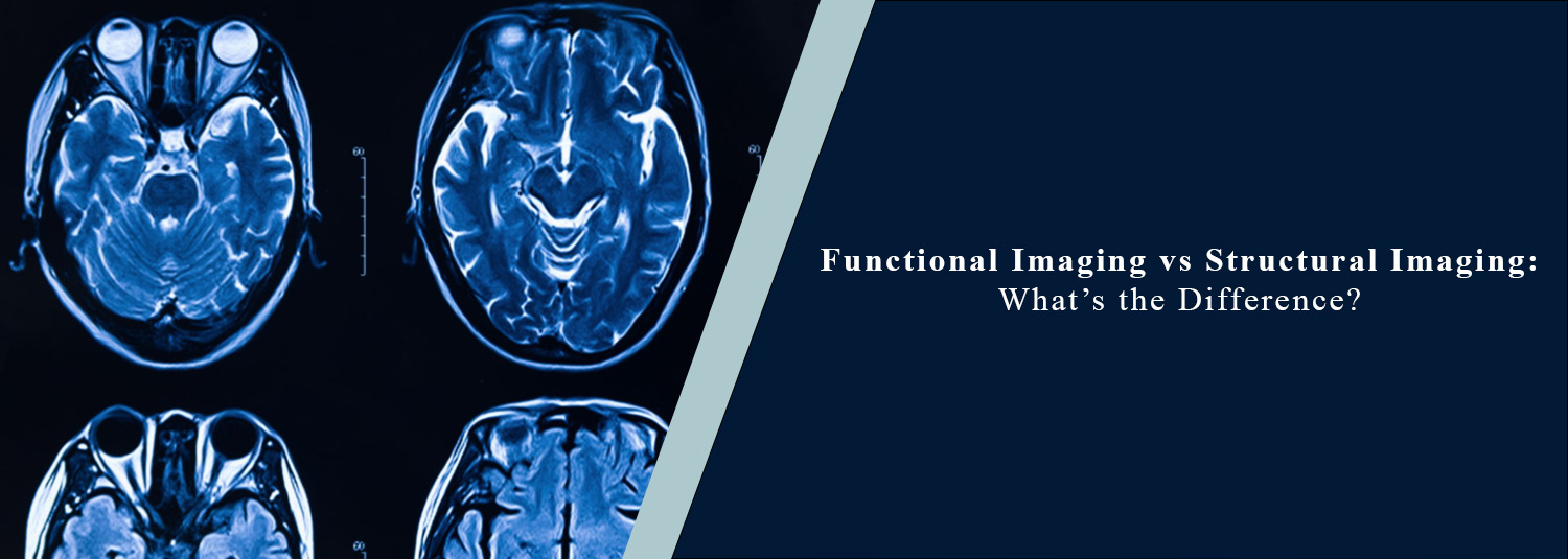Functional Imaging vs Structural Imaging: What’s the Difference?