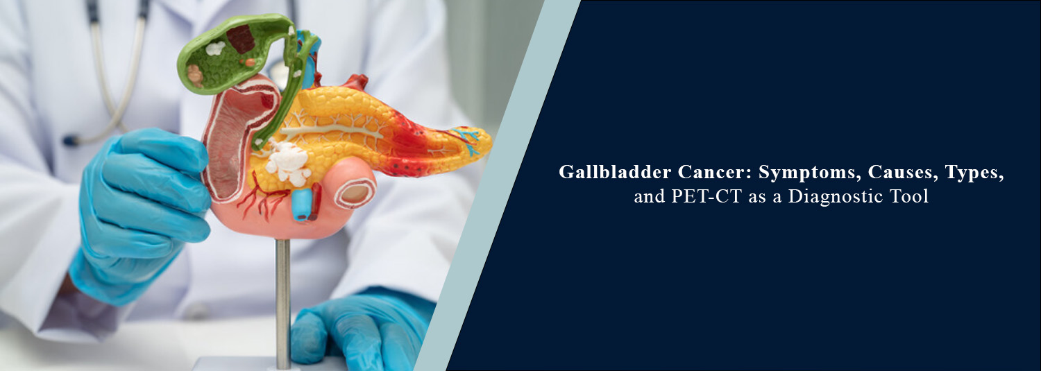 Gallbladder Cancer: Symptoms, Causes, Types, and PET-CT as a Diagnostic Tool