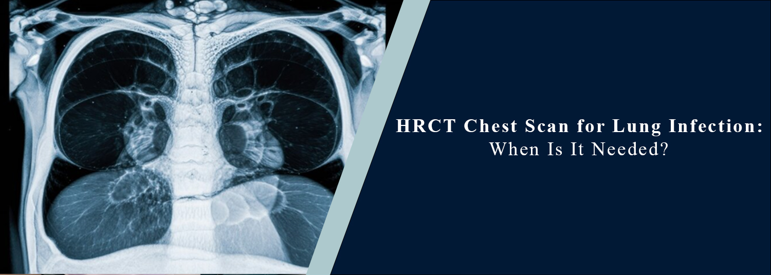 HRCT Chest Scan for Lung Infection: When Is It Needed?