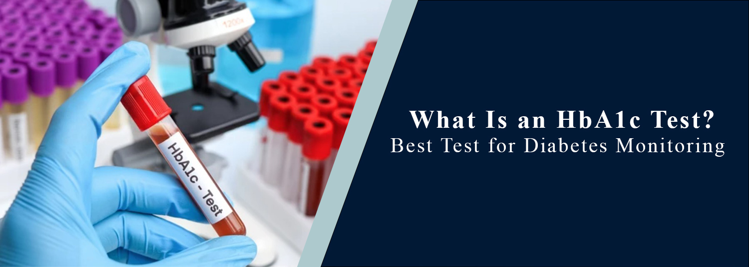What Is an HbA1c Test? Best Test for Diabetes Monitoring