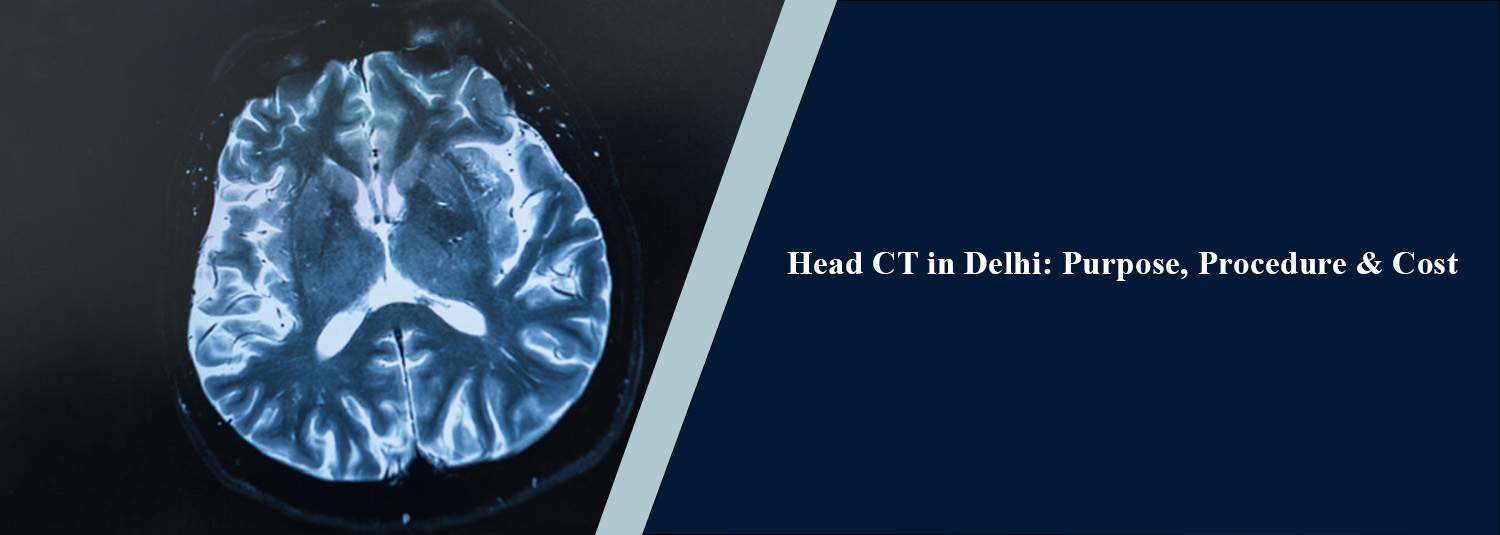 Head CT in Delhi: Purpose, Procedure and Cost