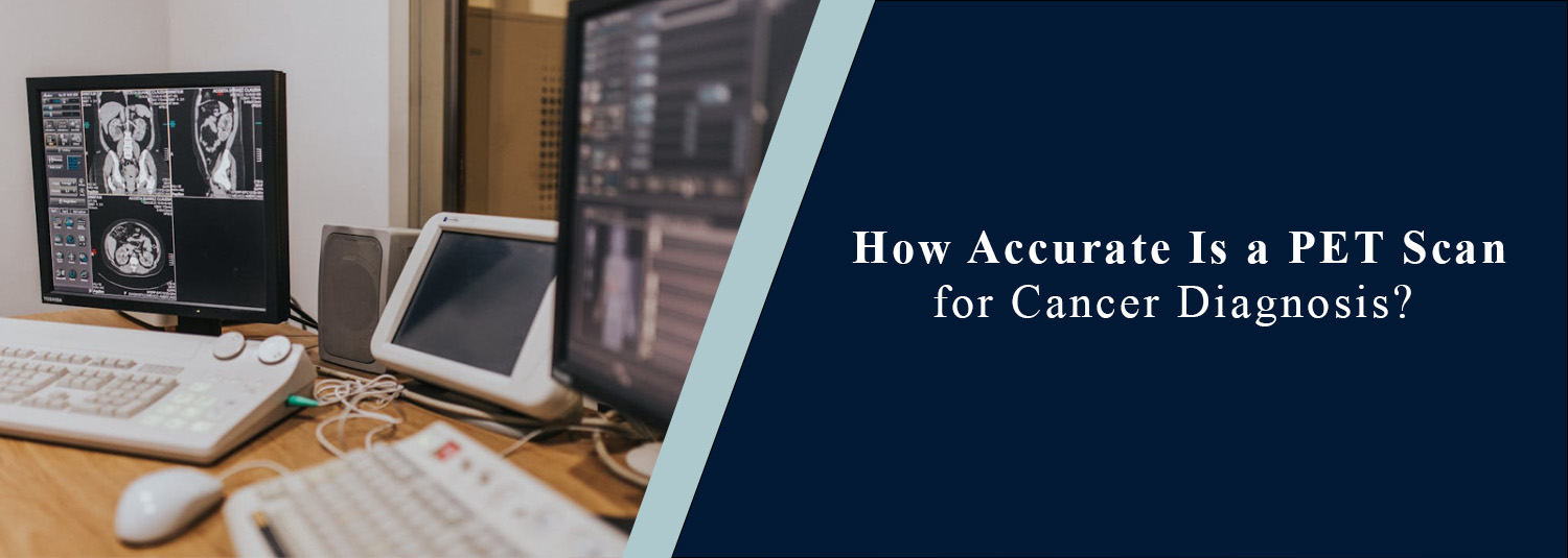 How Accurate Is a PET Scan for Cancer Diagnosis?