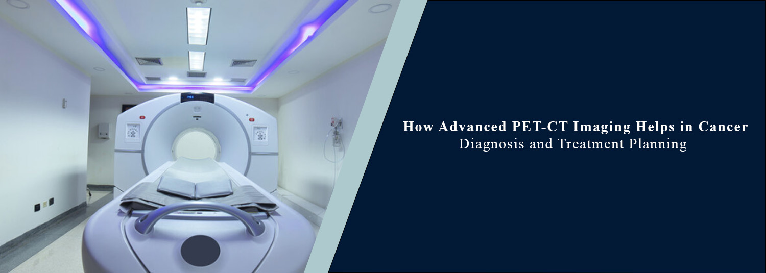 How Advanced PET-CT Imaging Helps in Cancer Diagnosis and Treatment Planning?