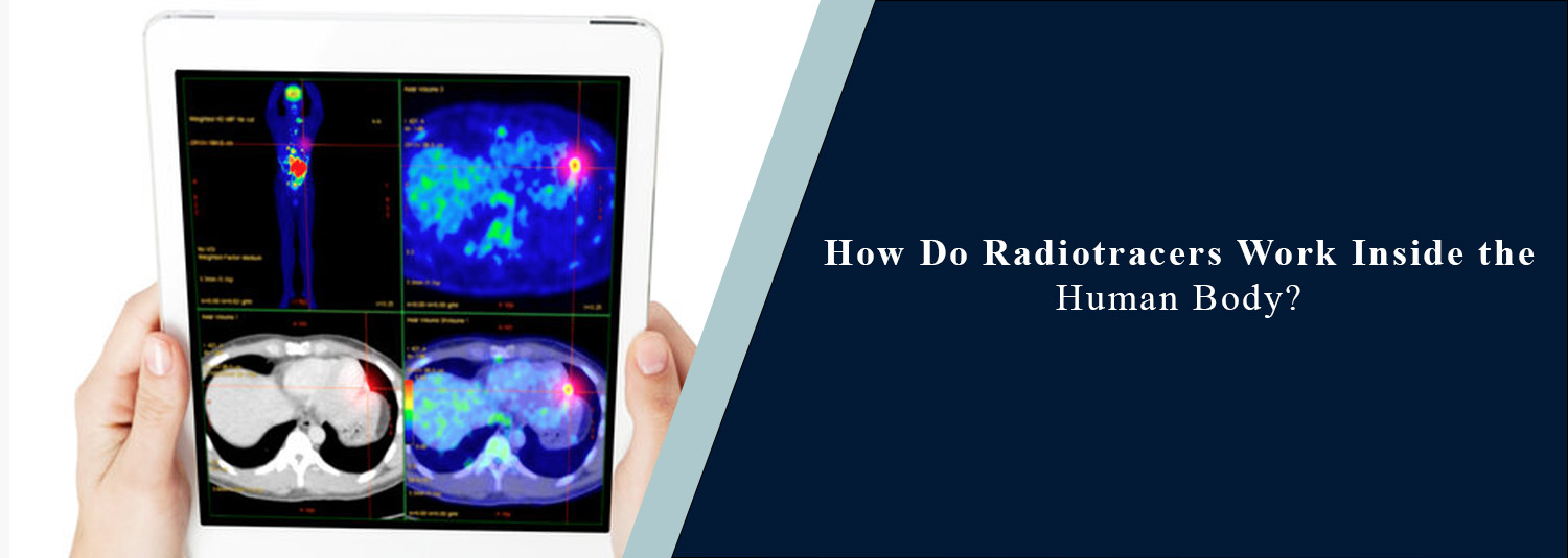 How Do Radiotracers Work Inside the Human Body?