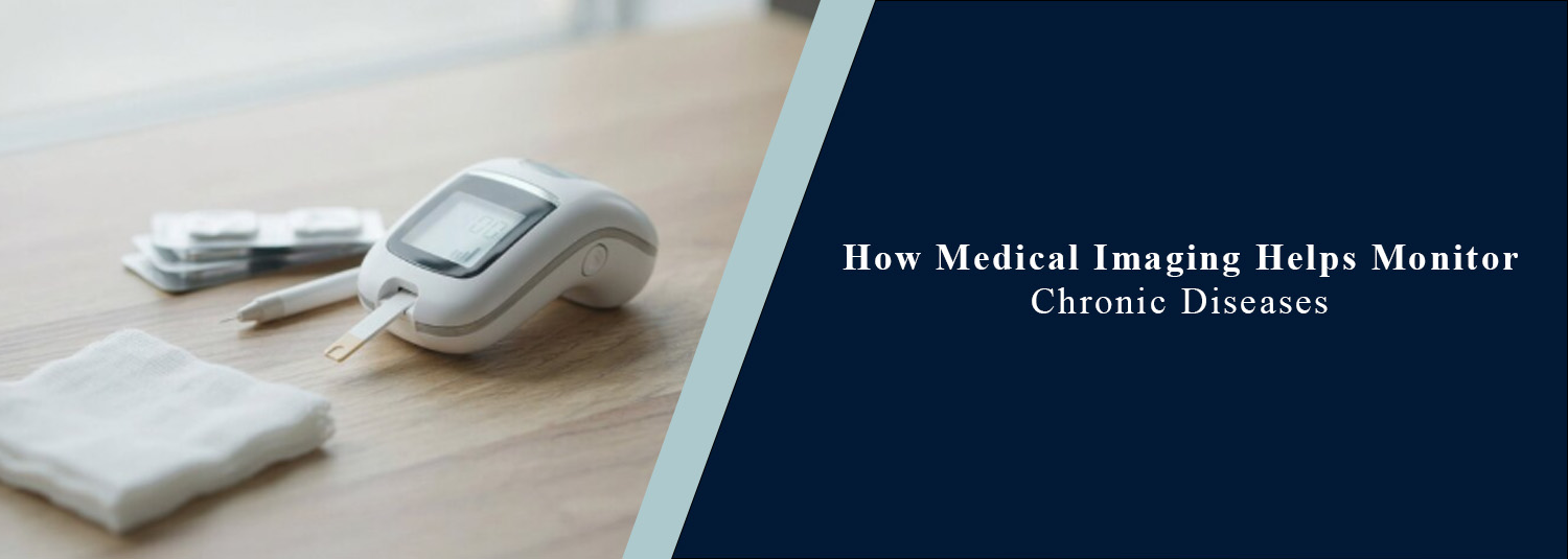 How Medical Imaging Helps Monitor Chronic Diseases?