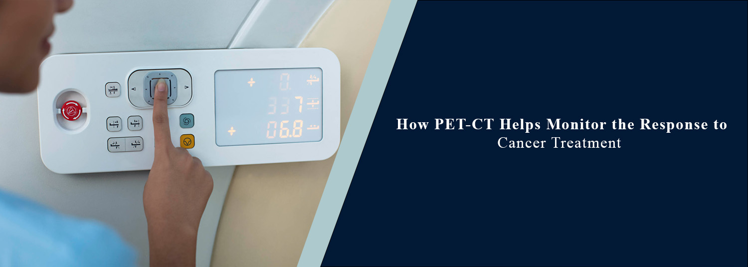 How Does PET-CT Help Monitor the Response to Cancer Treatment?