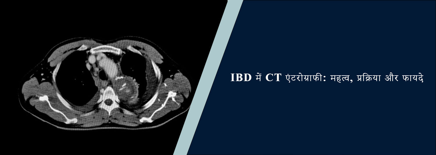 IBD में CT एंटरोग्राफी: महत्व, प्रक्रिया और फायदे