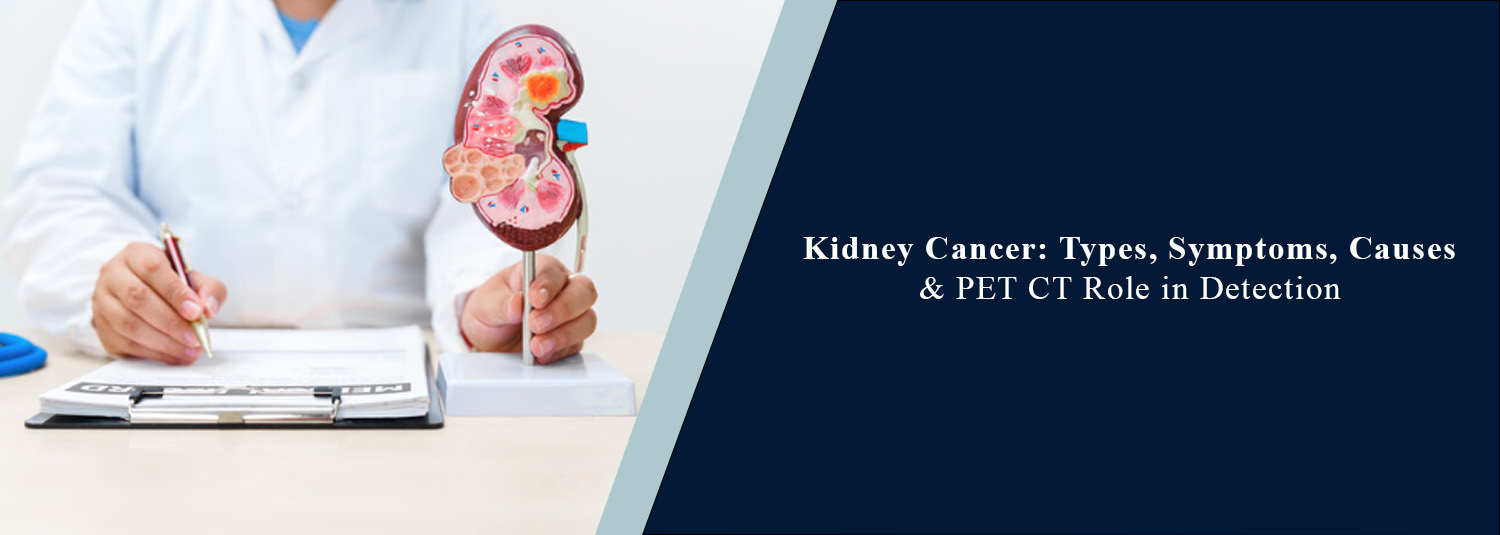Kidney Cancer: Symptoms, Causes, and PET-CT Role in Detection