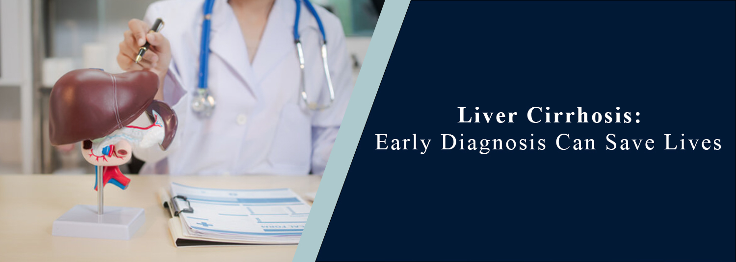 Liver Cirrhosis: Early Diagnosis Can Save Lives