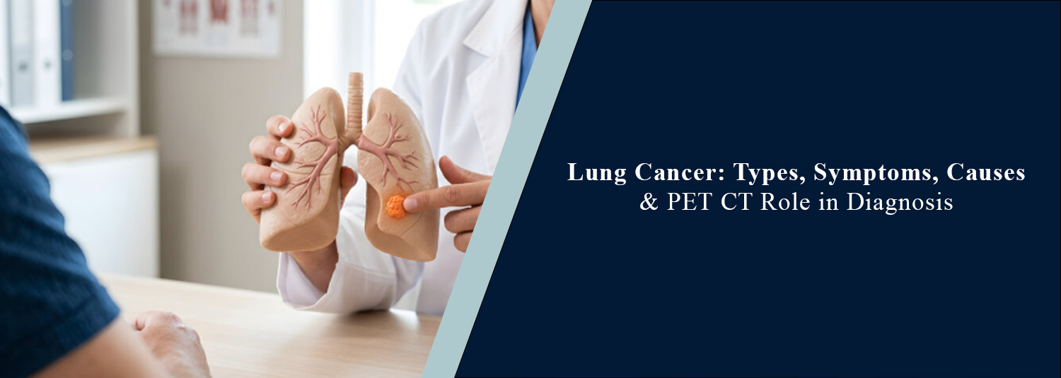 Lung Cancer: Types, Symptoms, Causes, and PET-CT Role in Diagnosis
