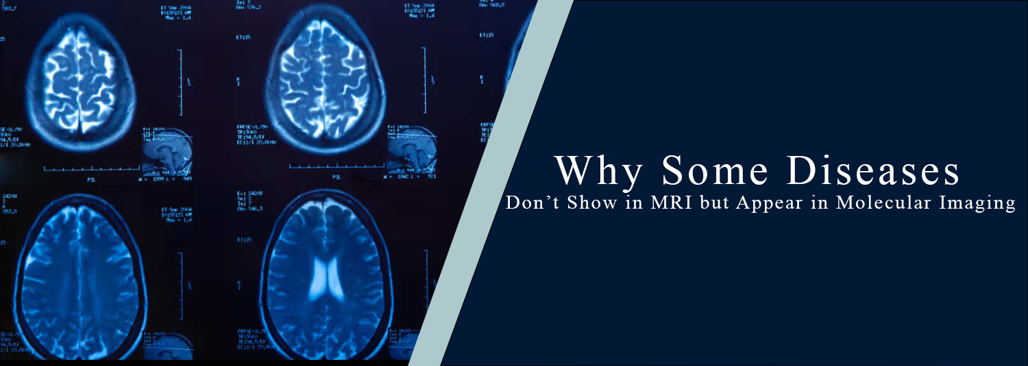 Why Some Diseases Don’t Show in MRI but Appear in Molecular Imaging?