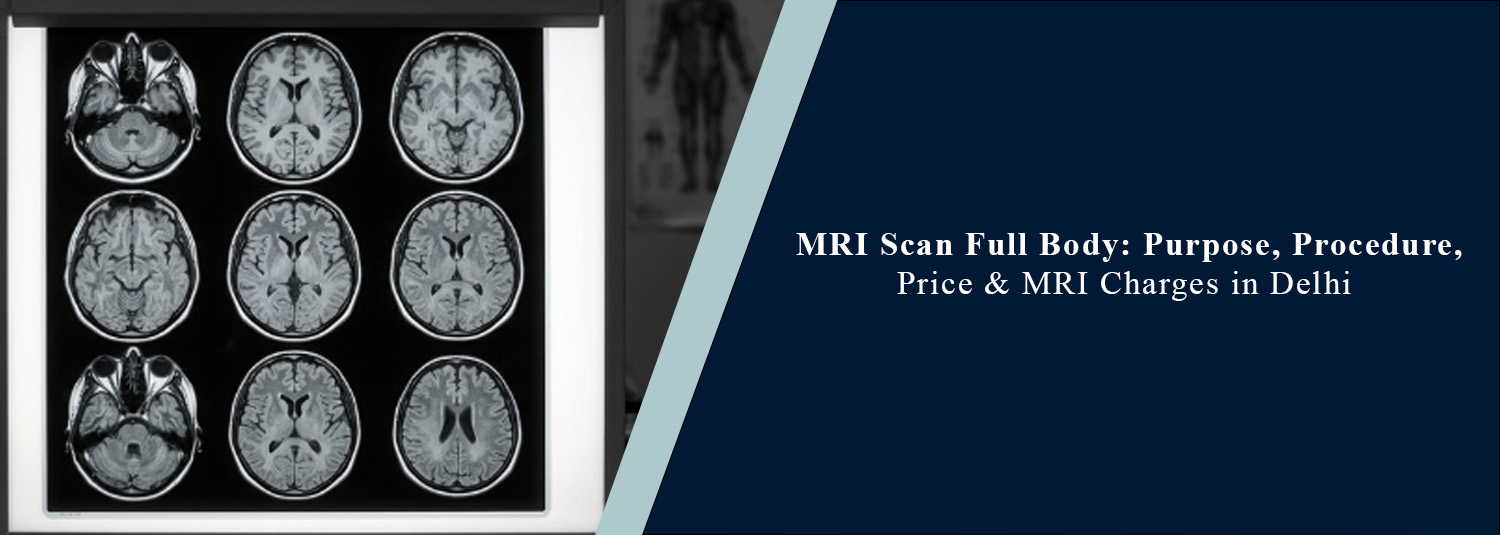MRI Scan Full Body: Purpose, Procedure, Preparation & What You Should Know