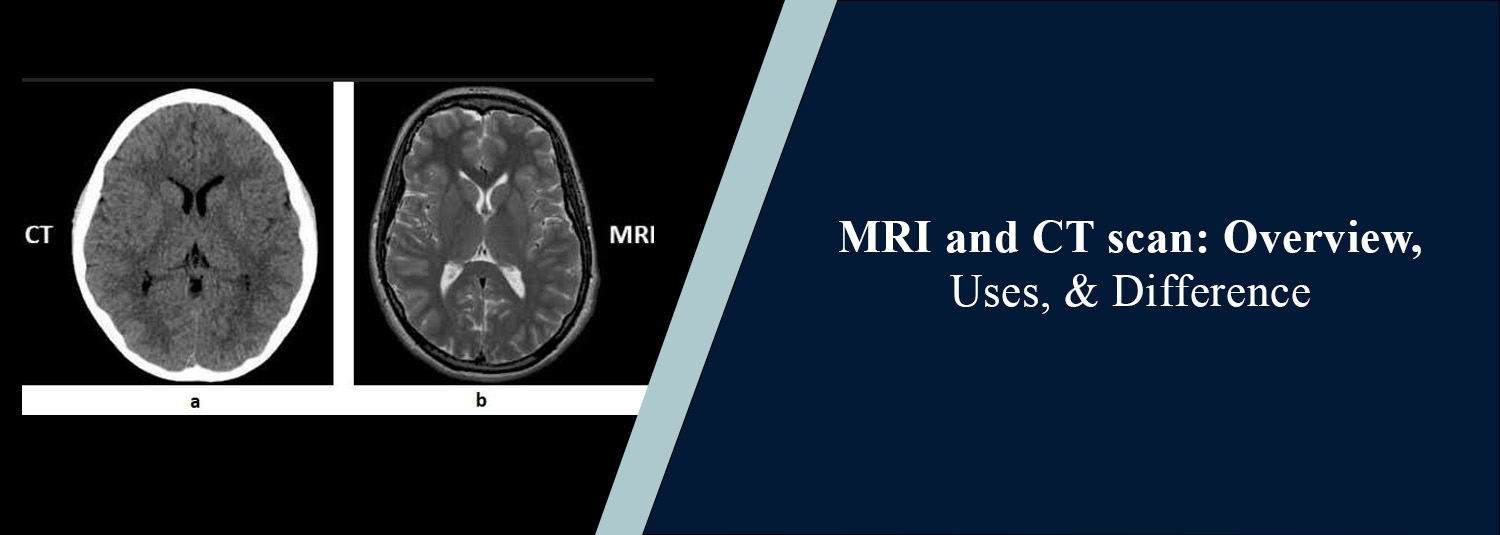 MRI and CT Scan: Overview, Uses, & Difference