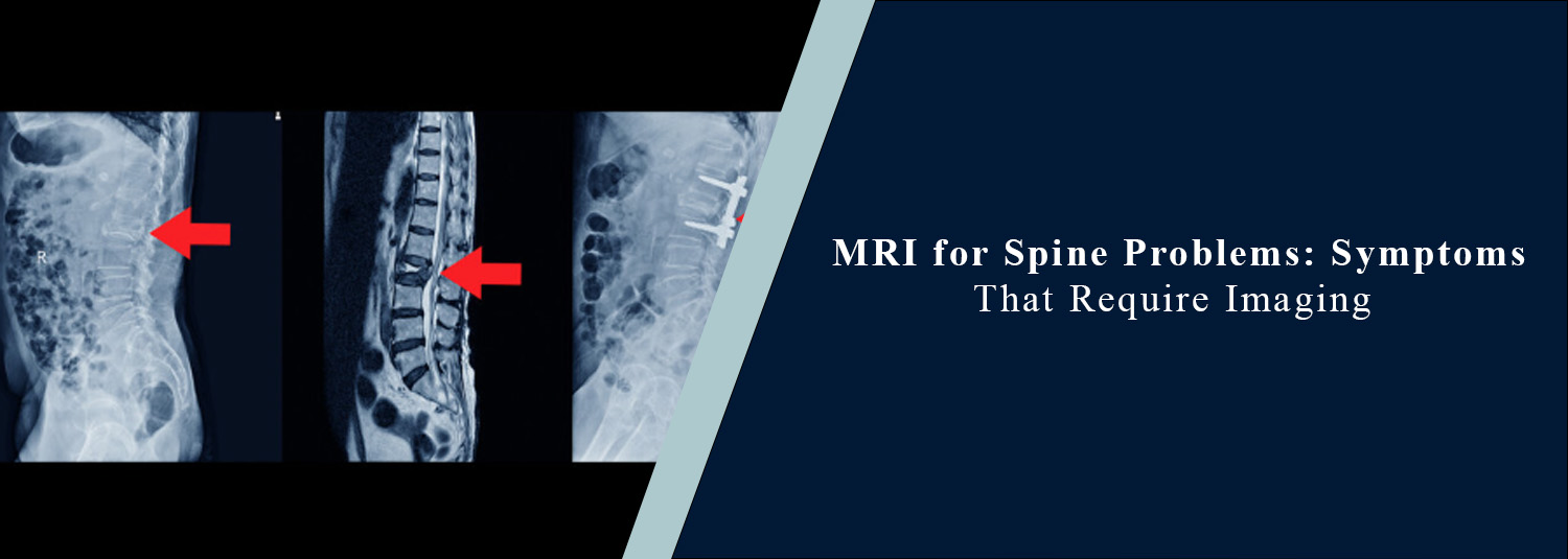 MRI for Spine Problems: Symptoms That Require Imaging