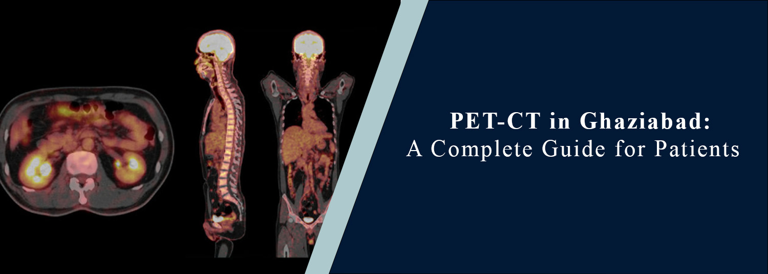 PET-CT in Ghaziabad: A Complete Guide for Patients