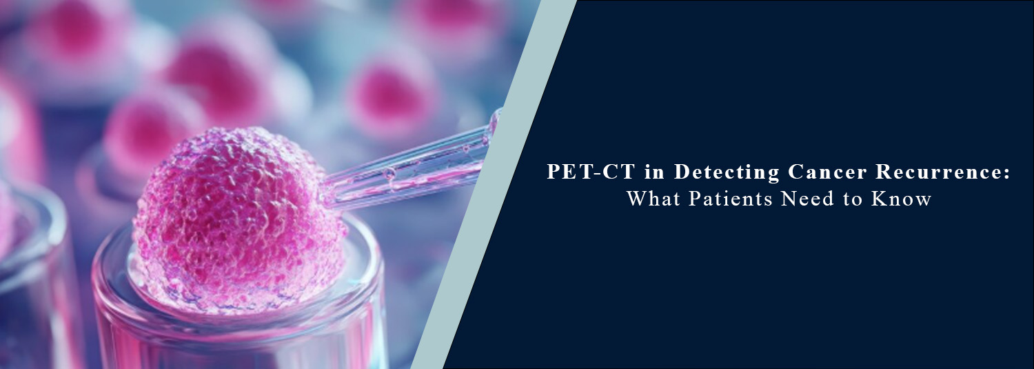 PET-CT in Detecting Cancer Recurrence: What Patients Need to Know?