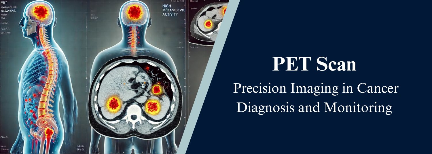 PET Scan: Precision Imaging in Cancer Diagnosis and Monitoring