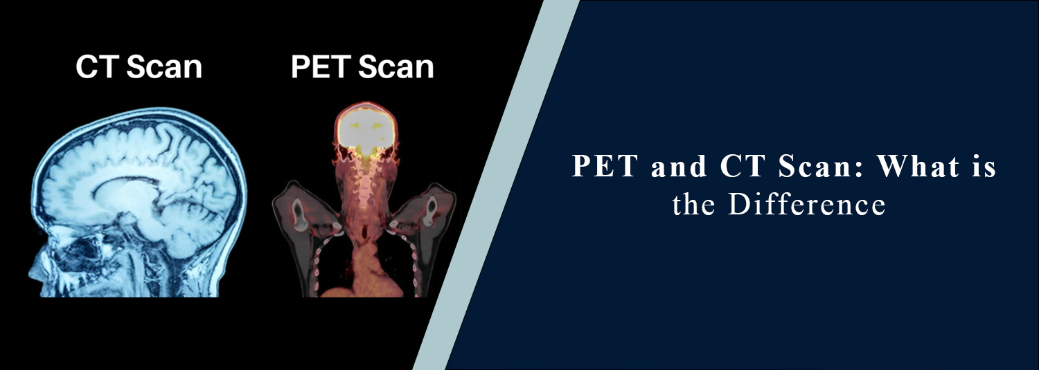 PET and CT Scan: What Is the Difference?