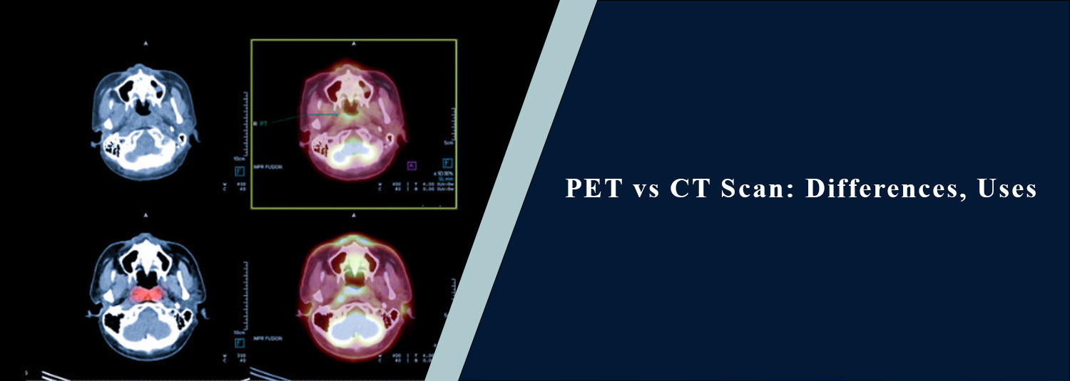 PET vs CT Scan: Differences, Uses
