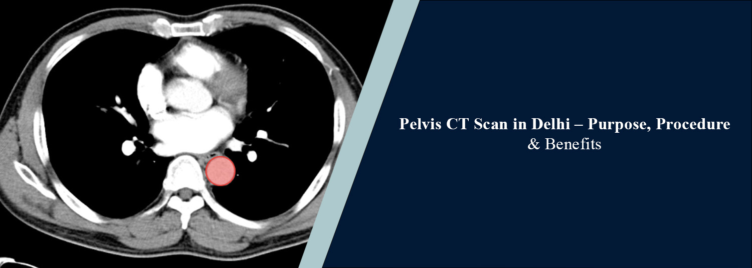 Pelvis CT Scan in Delhi – Purpose, Procedure & Benefits