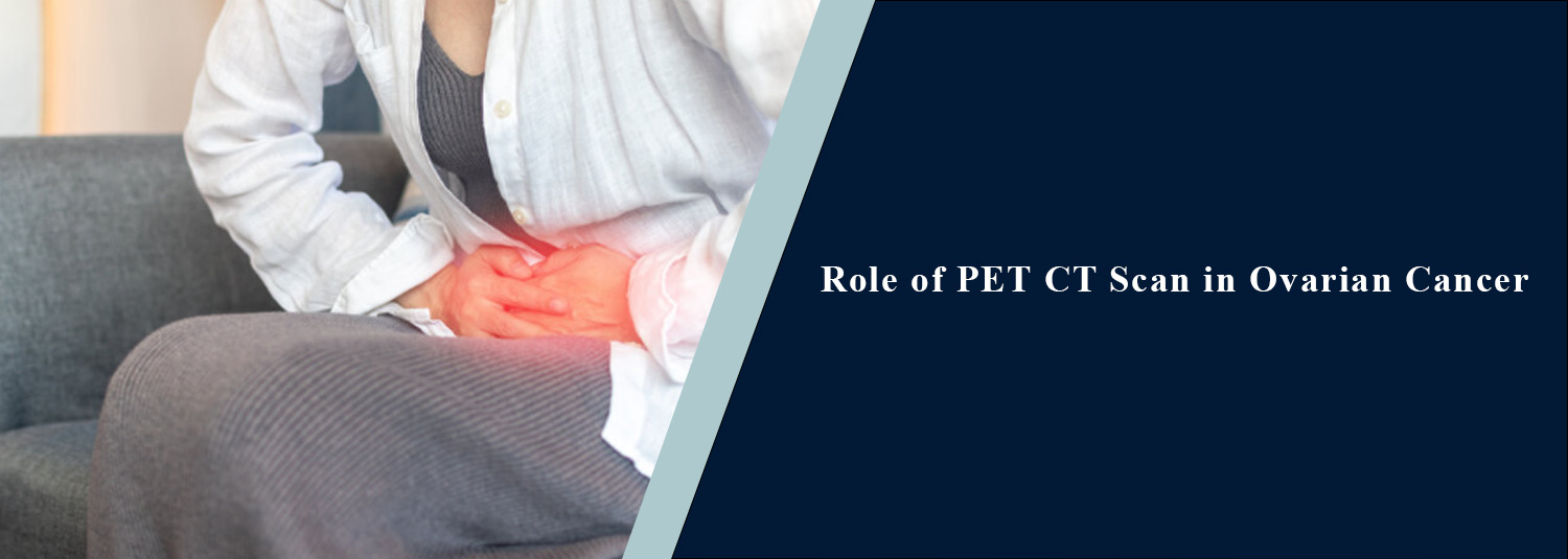 Role of PET-CT Scan in Ovarian Cancer