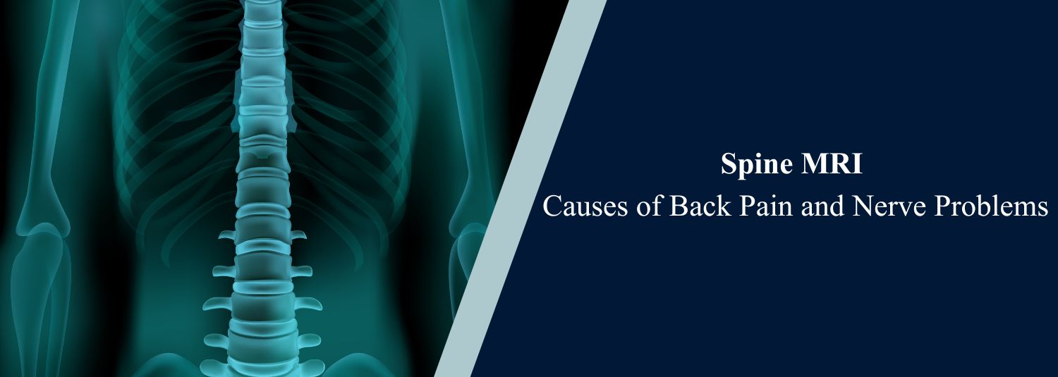 Spine MRI Scan: Diagnosing Back Pain and Nerve Issues