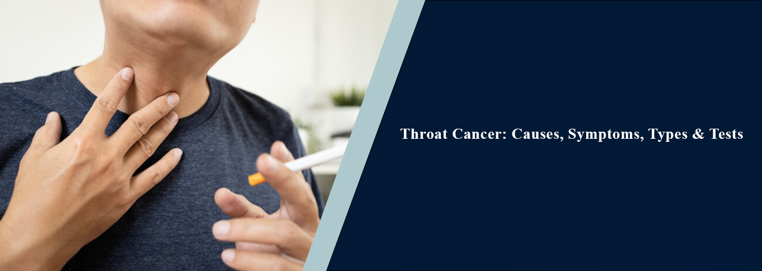 Throat Cancer: Causes, Symptoms, Types & Tests