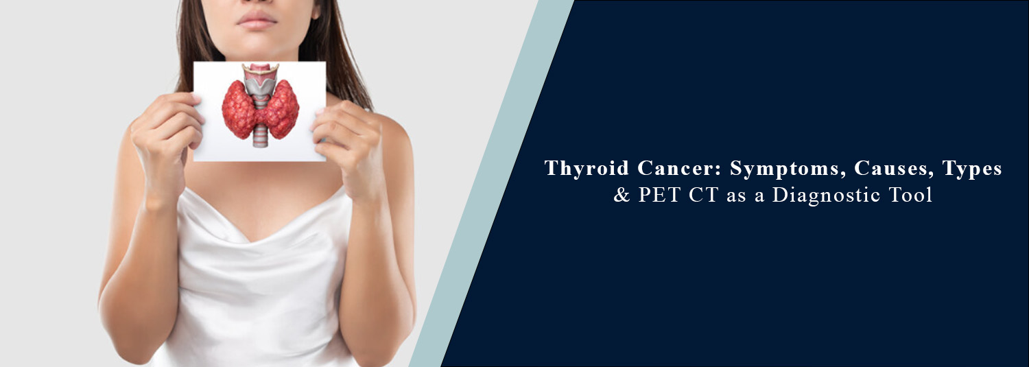Thyroid Cancer: Symptoms, Causes, Types & PET CT as a Diagnostic Tool