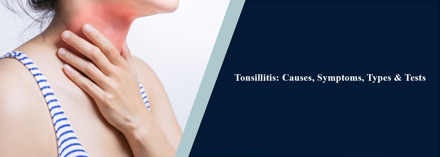 Tonsillitis: Causes, Symptoms, Types & Tests