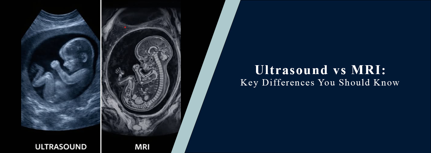 Ultrasound vs MRI: Key Differences You Should Know