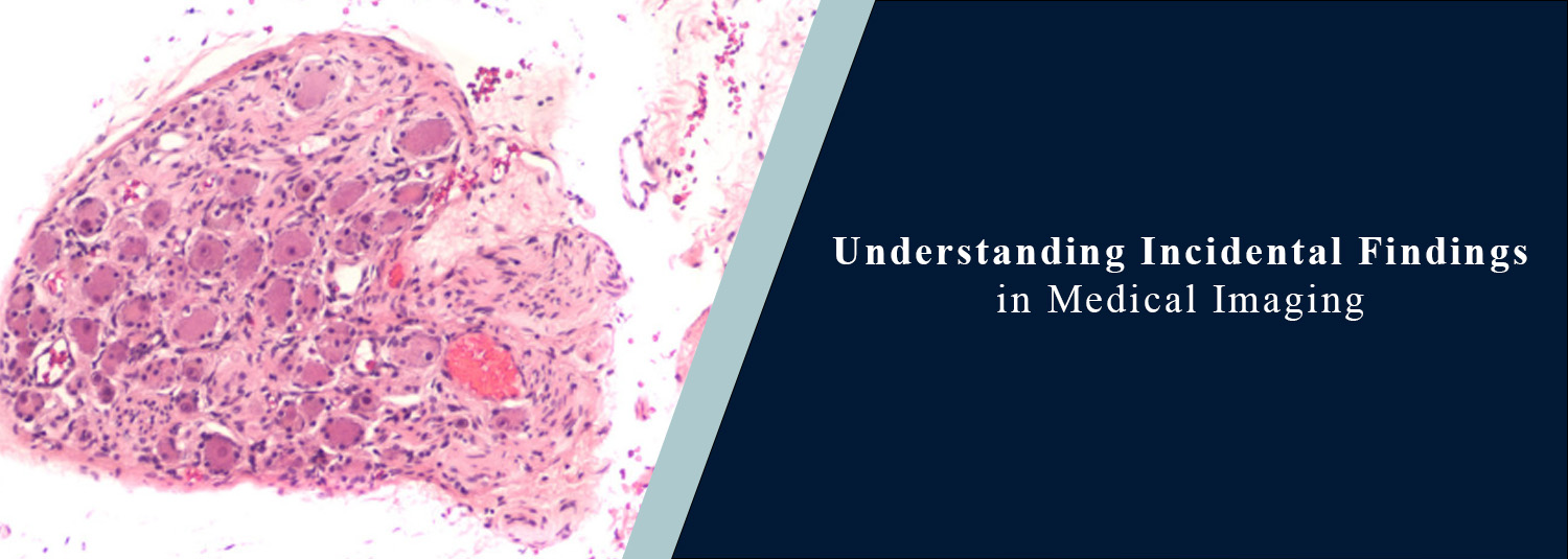 Understanding Incidental Findings in Medical Imaging
