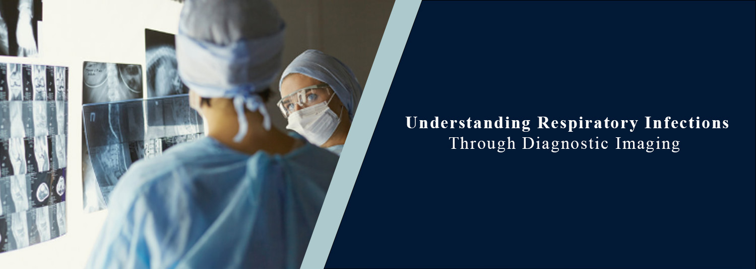 Understanding Respiratory Infections Through Diagnostic Imaging