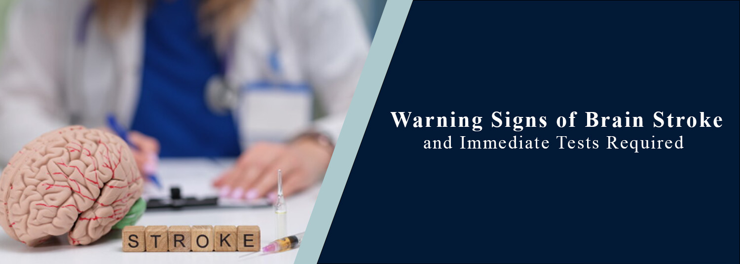 Warning Signs of Brain Stroke and Immediate Tests Required