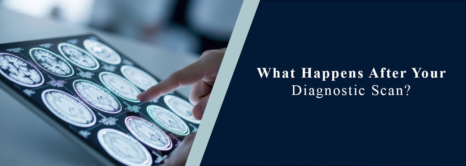 What Happens After Your Diagnostic Scan?
