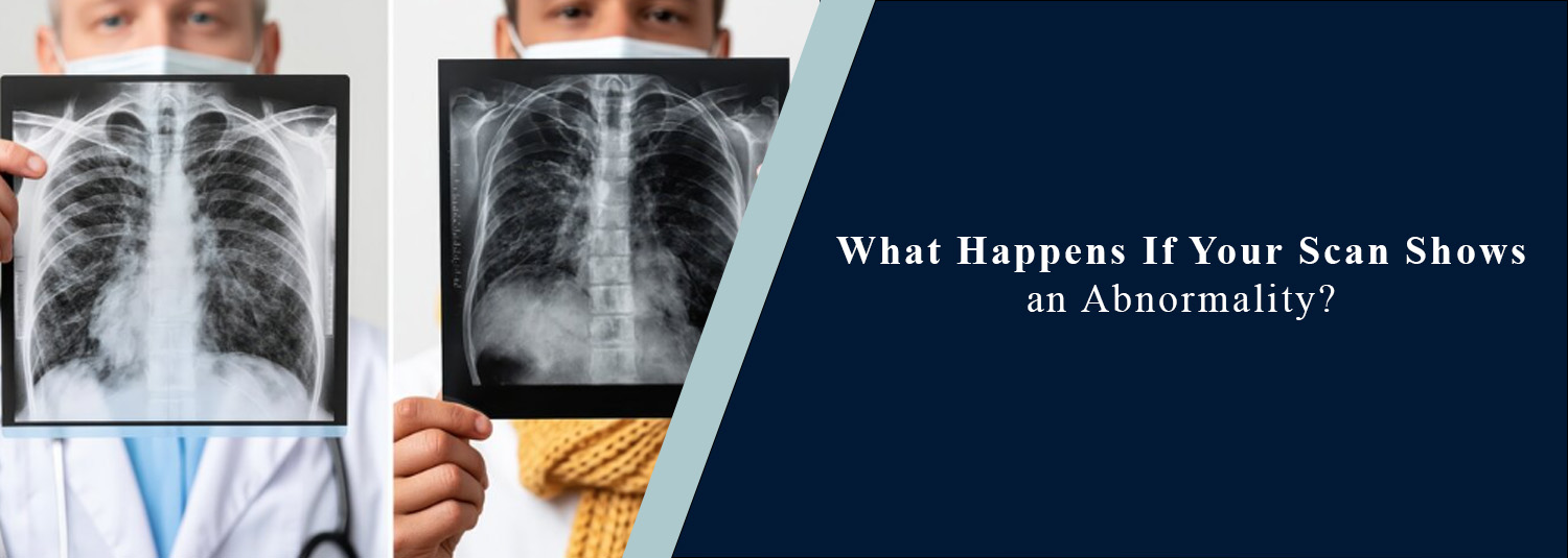What Happens If Your Scan Shows an Abnormality?