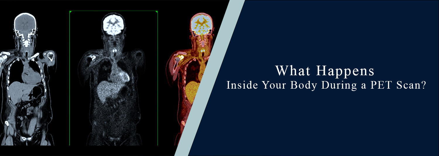 What Happens Inside Your Body During a PET Scan?