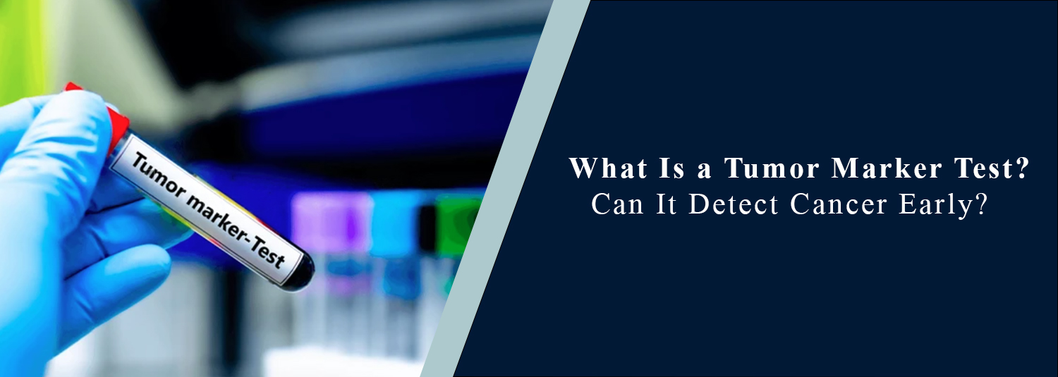 What Is a Tumor Marker Test? Can It Detect Cancer Early?