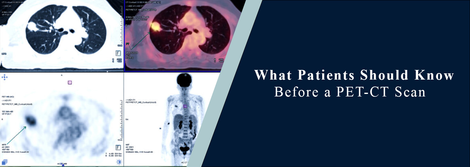 What Patients Should Know Before a PET-CT?
