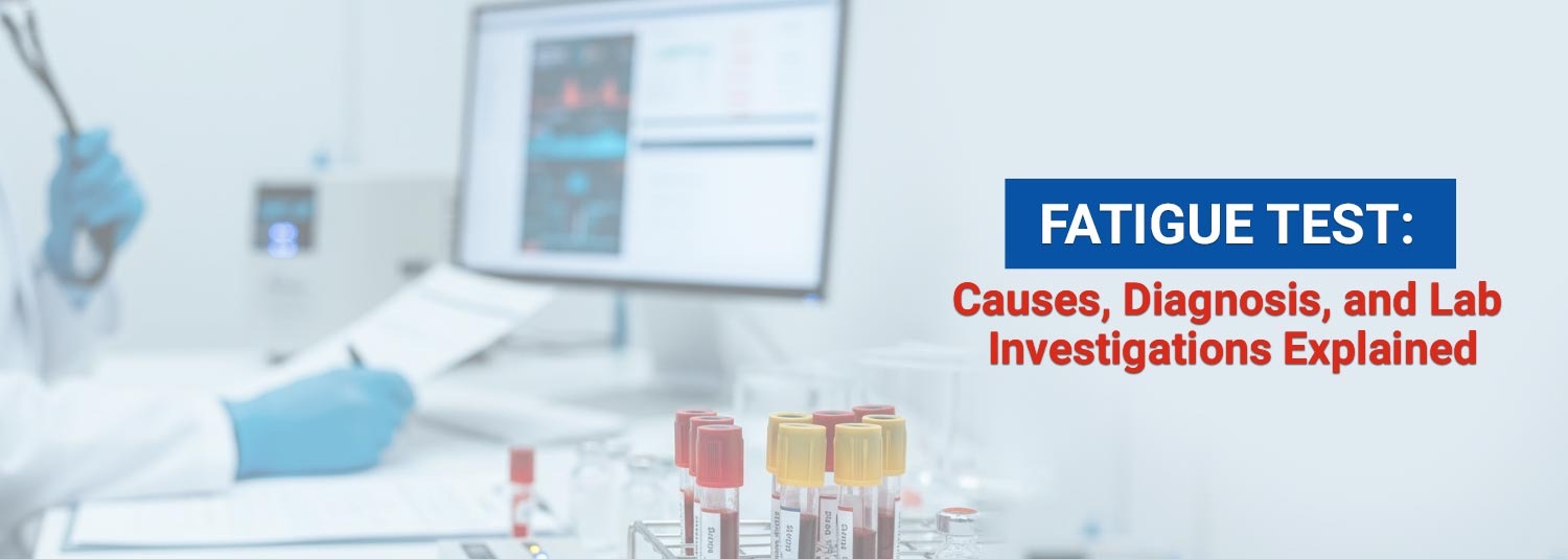 Fatigue Test: Causes, Diagnosis, and Lab Investigations Explained