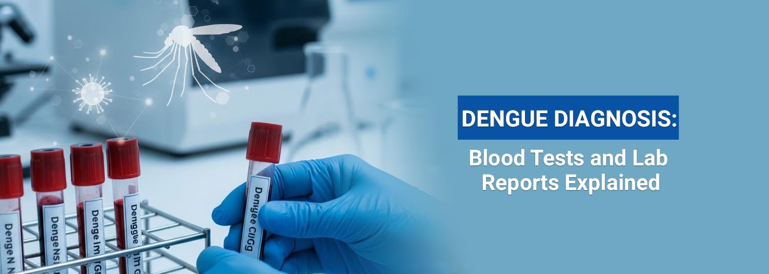 Dengue Diagnosis: Blood Tests and Lab Reports Explained