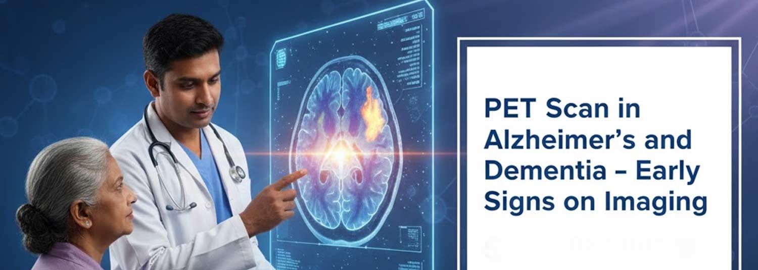 PET Scan in Alzheimer’s and Dementia – Early Signs on Imaging