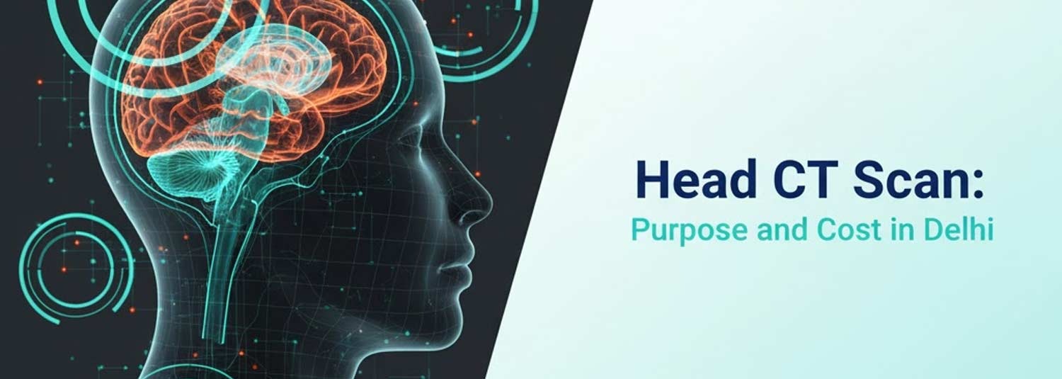 Head CT scan: Purpose and Cost in Delhi