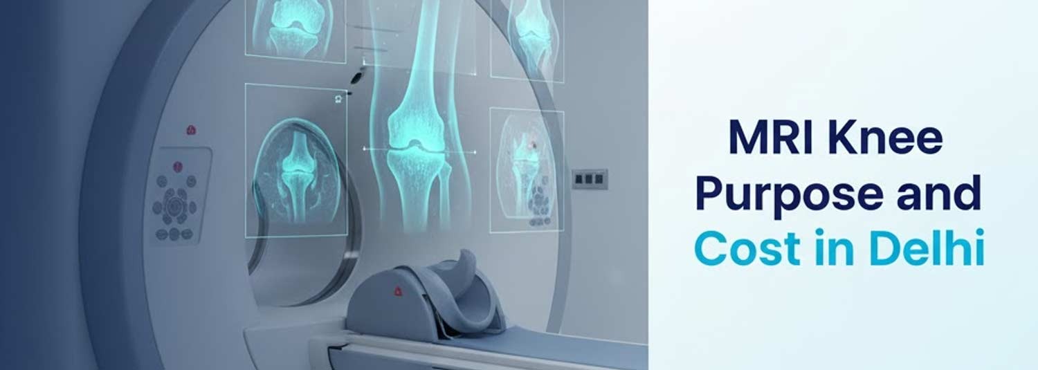 MRI Knee: Purpose and Cost in Delhi