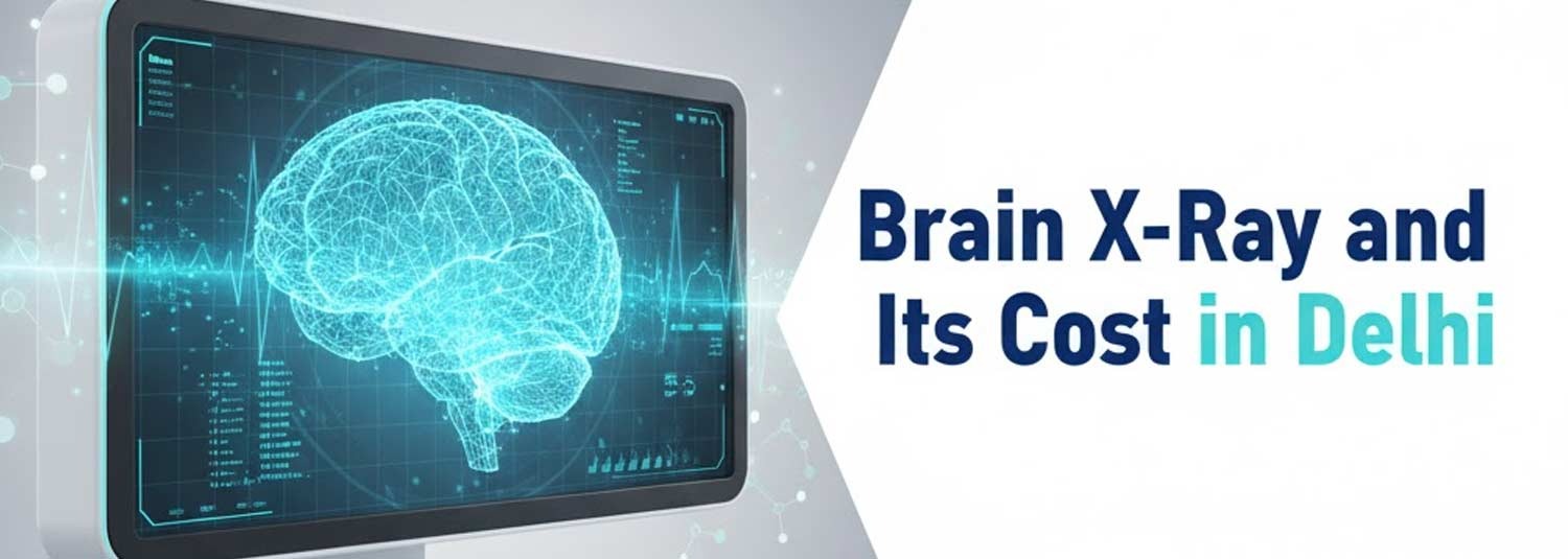 Brain X-ray and Its cost in Delhi