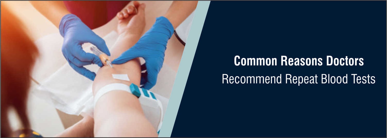 Common Reasons Doctors Recommend Repeat Blood Tests