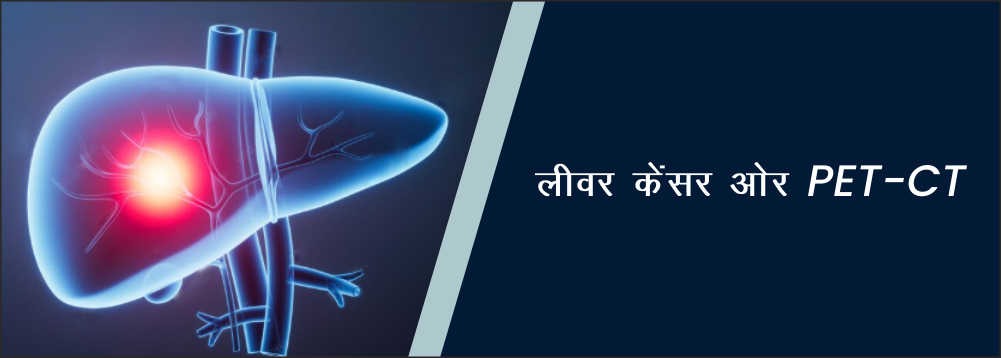 लिवर कैंसर और PET-CT