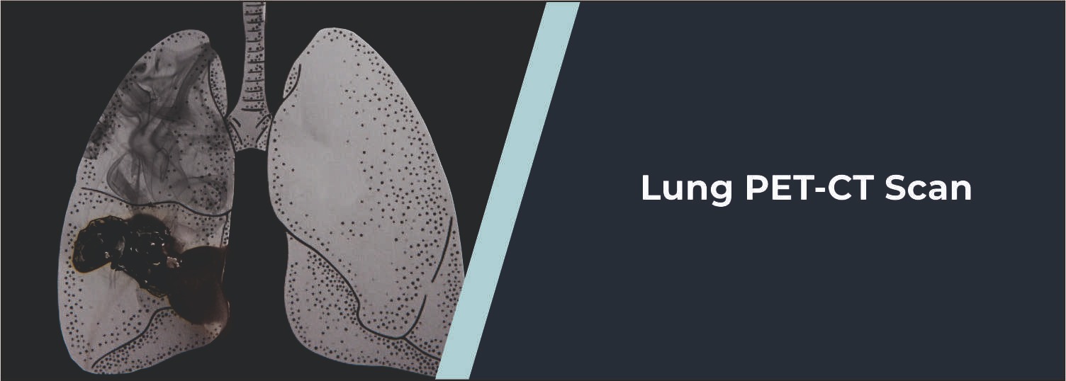 Lung PET-CT Scan: Uses, Procedure, Test Details and Accuracy